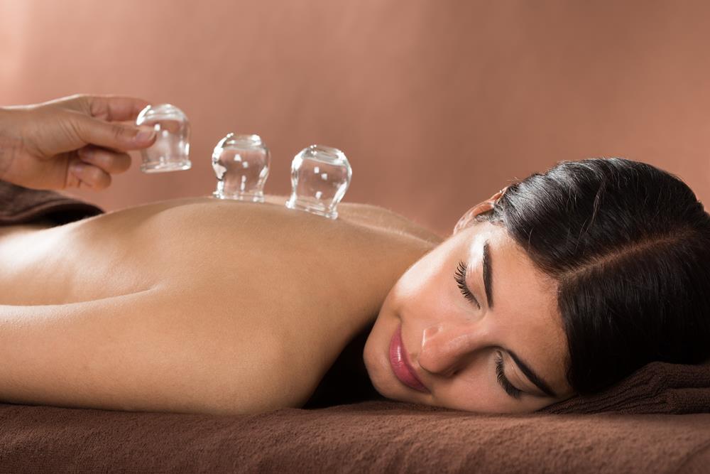Cupping therapy Ashburn VA