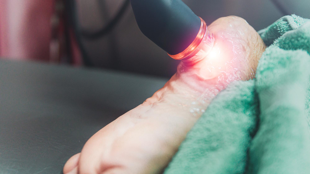 Shockwave therapy Ashburn VA